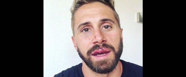 Gay Porn Star Wesley Woods Gay Bashing Attack