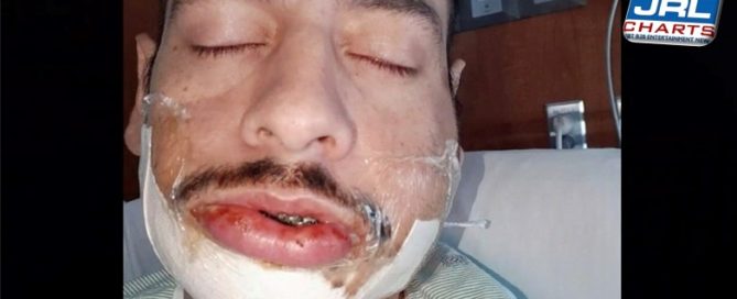 Gay Bar DJ Oscar Rodriguez Brutally Assaulted in Hate Crime Attack