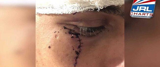 Man faces Hate Crime Charge in Snow Shovel, Box Cutter attack