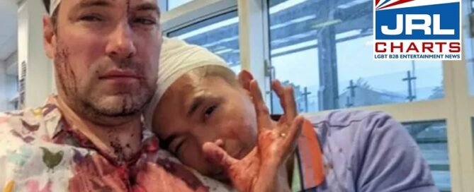 One Arrested, two at Large in Brutal Hate Crime Attack on Gay Men in Birmingham-2021-08-22-JRL-CHARTS
