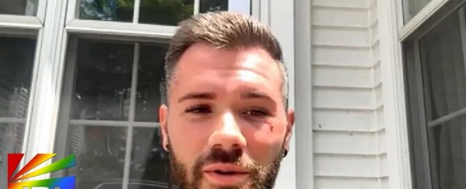 Chris Kostka shows injuries after Provincetown hate crime attack – photo via NBC Boston – JRL CHARTS LGBT Politics