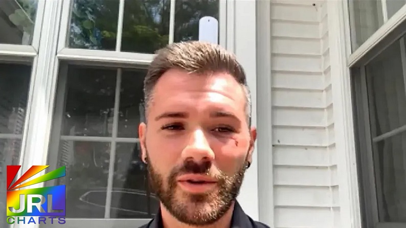 Chris Kostka shows injuries after Provincetown hate crime attack – photo via NBC Boston – JRL CHARTS LGBT Politics