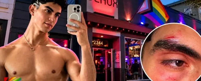 Editorial composite of Alfonso Osnaya with Beaux Nightclub in San Francisco’s Castro District and an inset showing injuries he reported following an alleged attack.